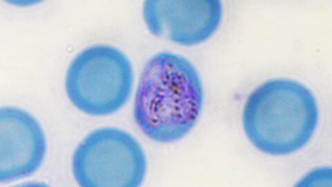 Malaria, dall’IRB di Bellinzona nuovi bersagli per vaccini più efficaci Sottotitolo Uno studio pubblicato su Nature individua centinaia di antigeni del parassita riconosciuti dai linfociti T CD8+, aprendo nuove prospettive per una protezione più ampia contro la malaria